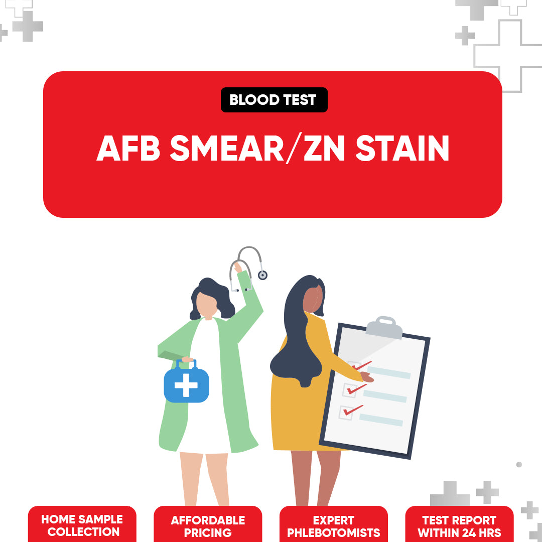 AFB Smear / ZN Stain Test