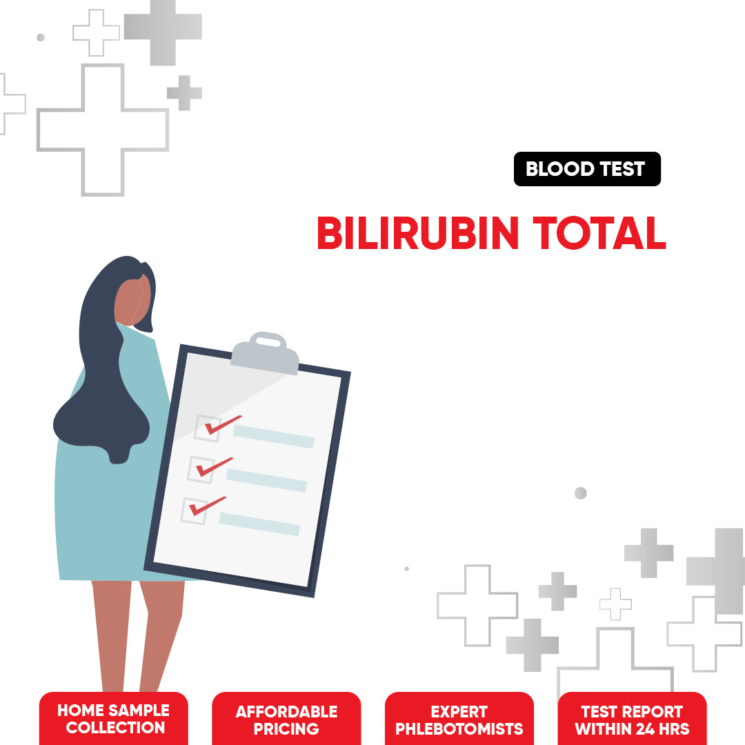 Bilirubin Total Test