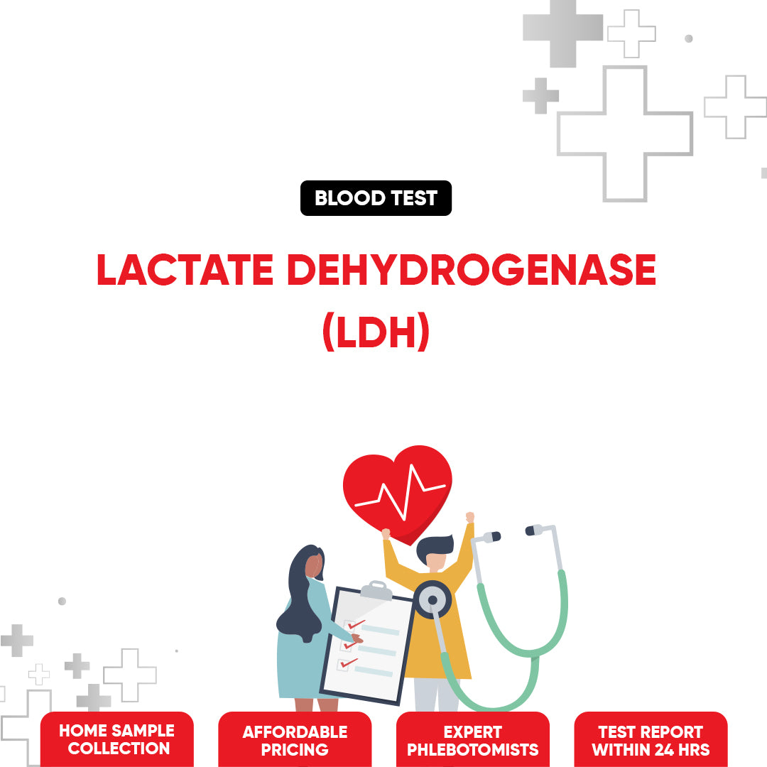 Lactate Dehydrogenase (LDH) Test
