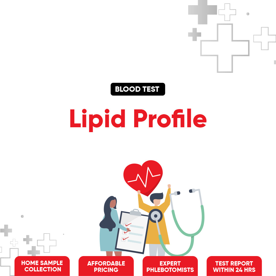 Lipid Profile Test