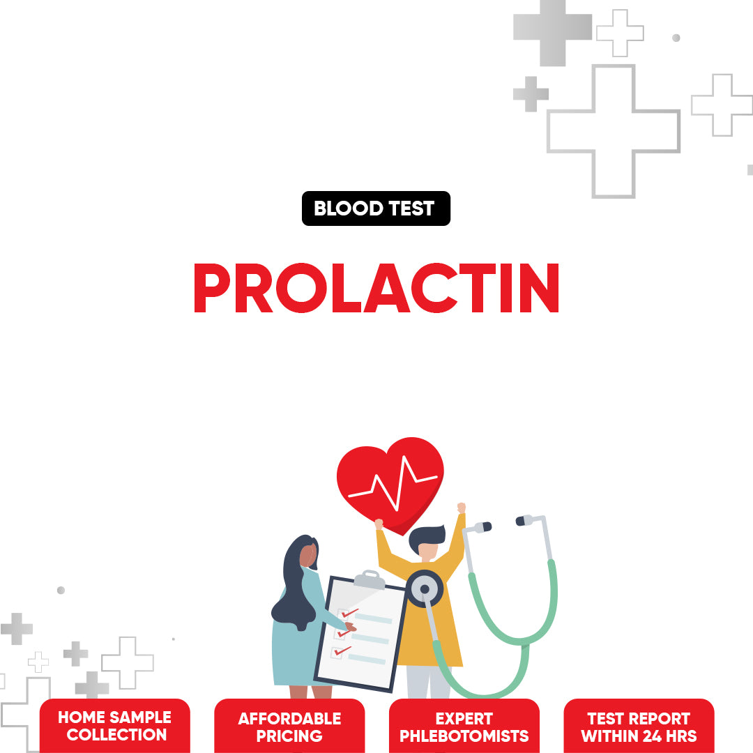 Prolactin Test