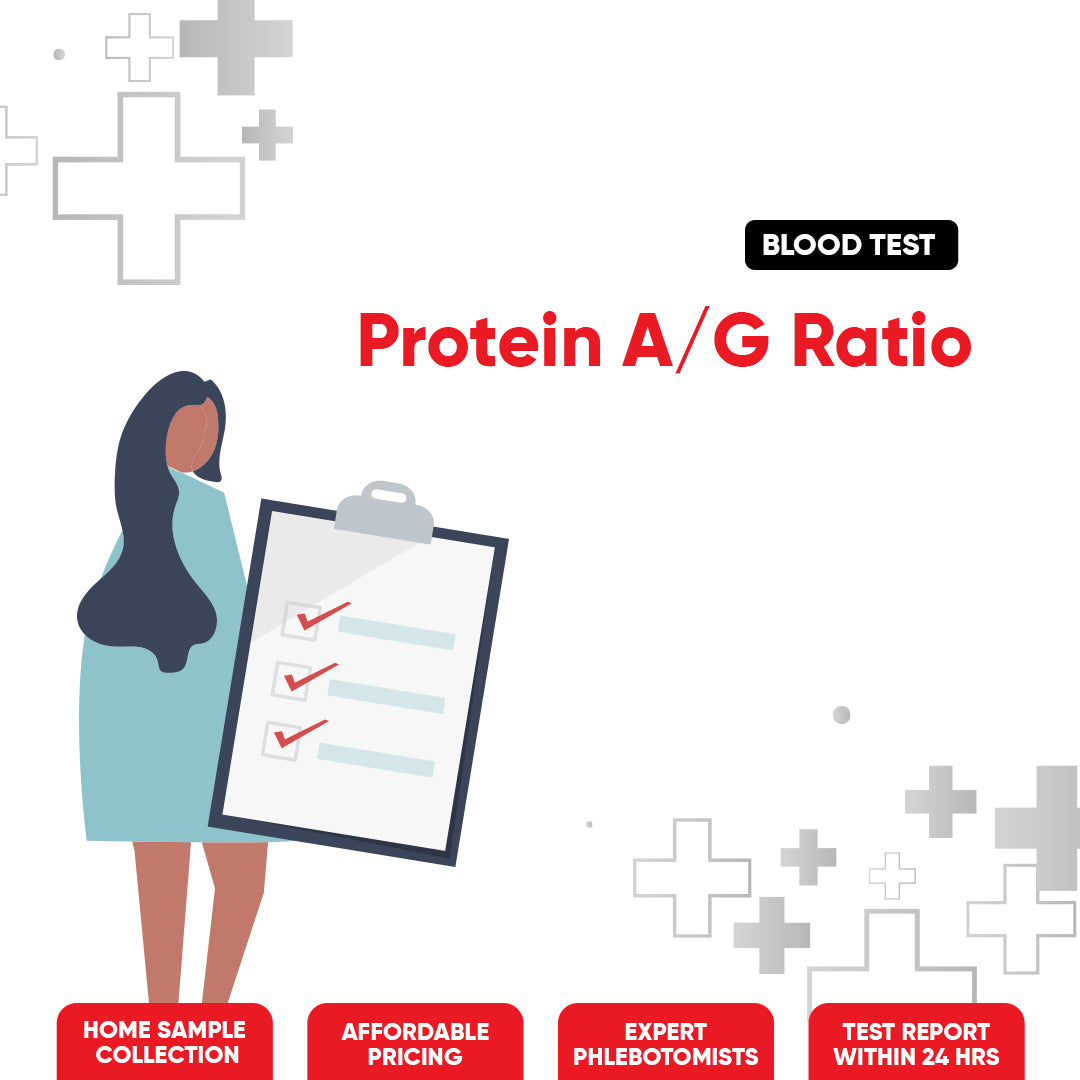 Protein A/G Ratio Test