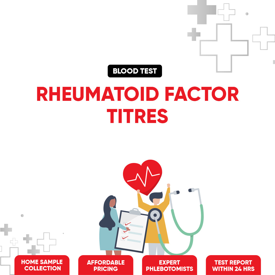 Rheumatoid Factor Titre Test