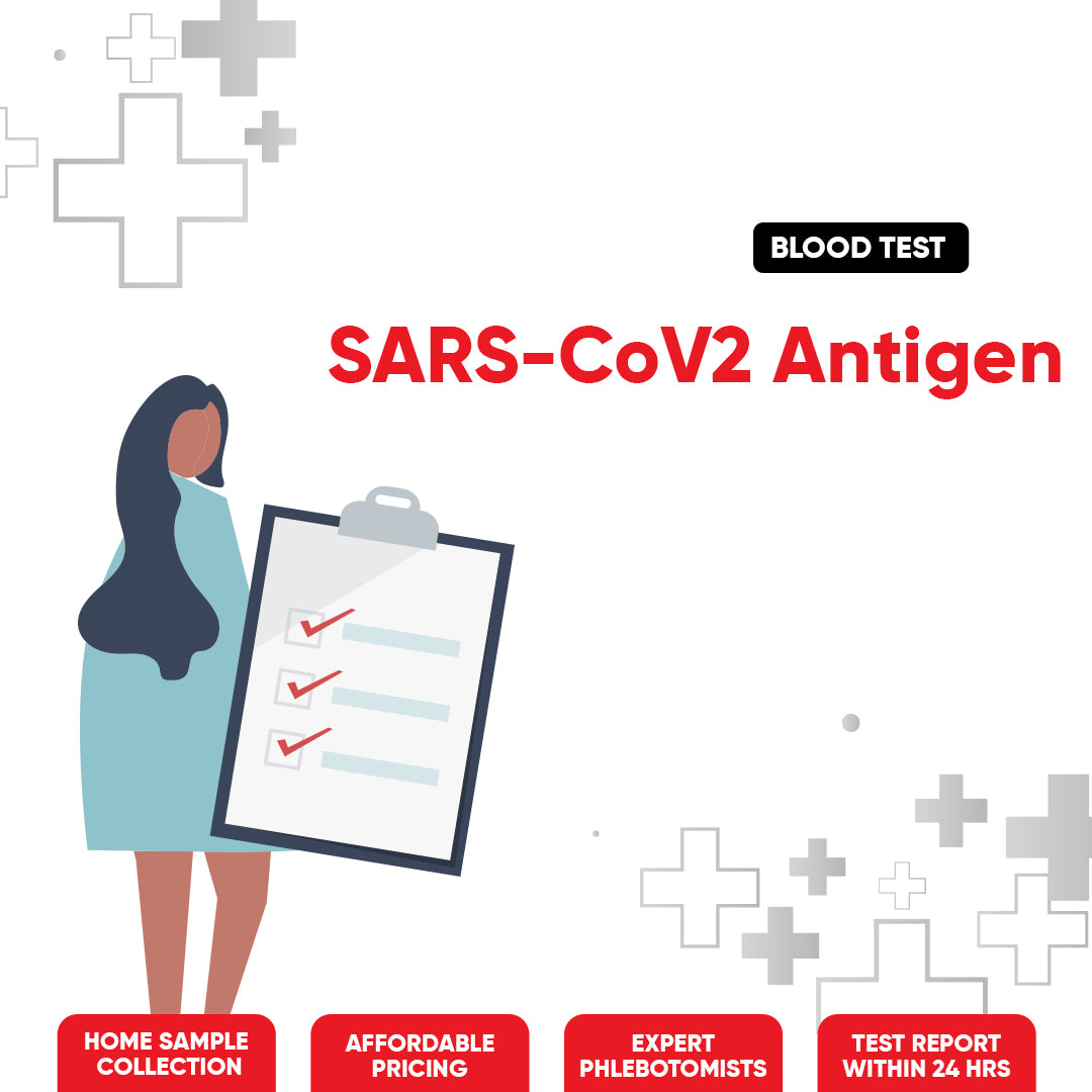 SARS-CoV2 Antigen
