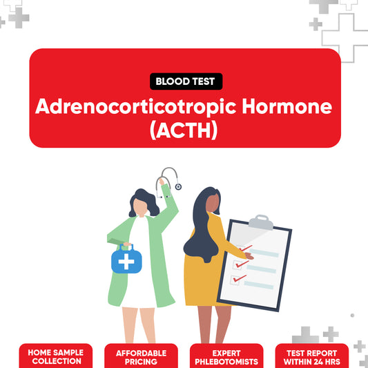 Adrenocorticotropic Hormone (ACTH) Test