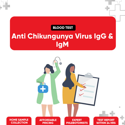 Anti Chikungunya Virus IgG & IgM Test