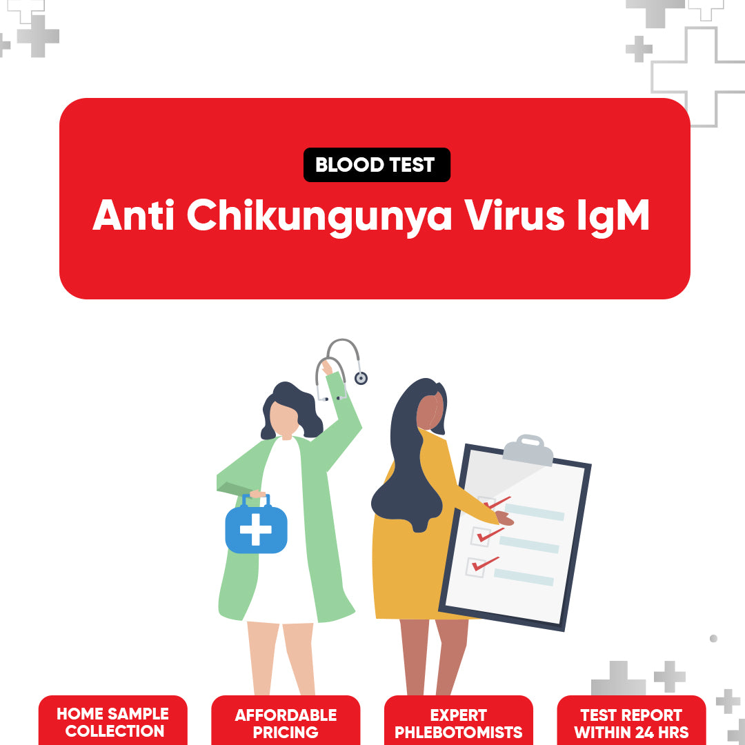 Anti Chikungunya Virus IgM Test