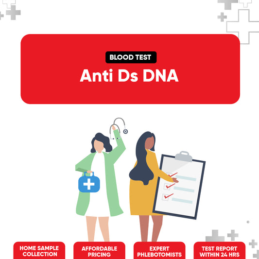 Anti Ds DNA Test