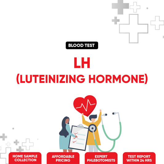 LH (Luteinizing hormone) Test